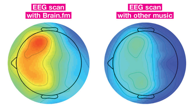 Music and the Brain: What Happens When You're Listening to Music