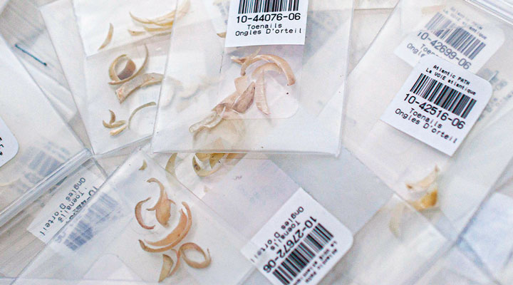 Labeled bags containing preserved parasitic worms for scientific study